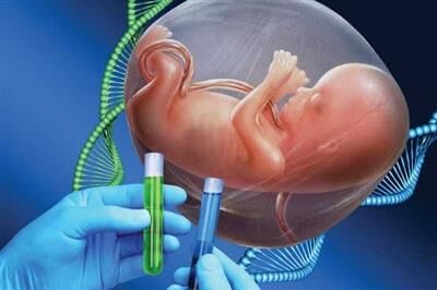 تشخیص علل ژنتیکی ناهنجاری های مادرزادی